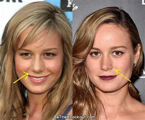 did brie larson have a boob job|Brie Larson’s Plastic Surgery – What We Know So Far